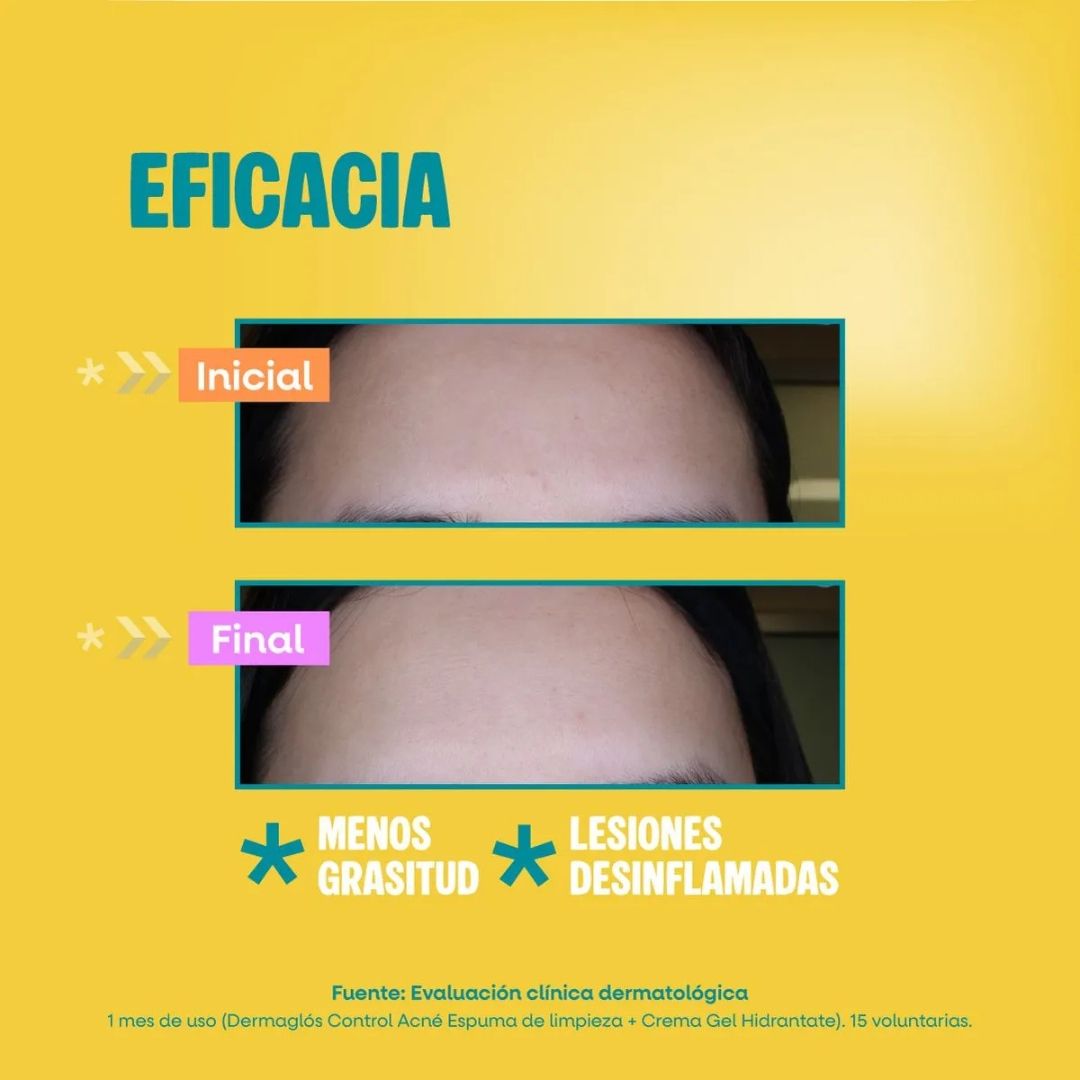 espuma-de-limpieza-facial-anti-acne-dermaglos-control-x-150-ml-113350
